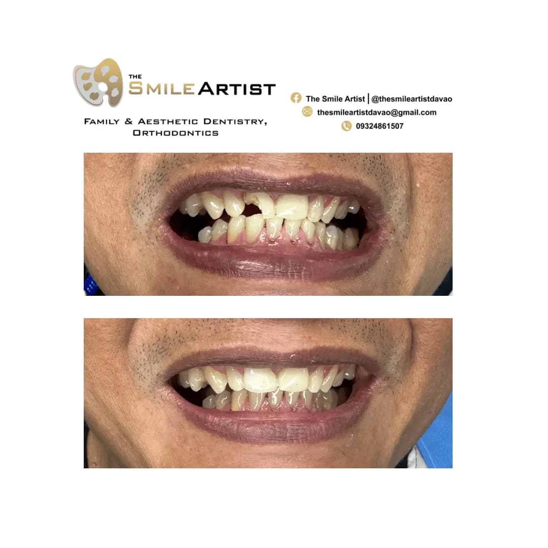 Dental Treatment Result