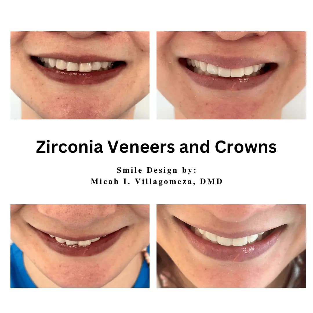 Dental Treatment Result