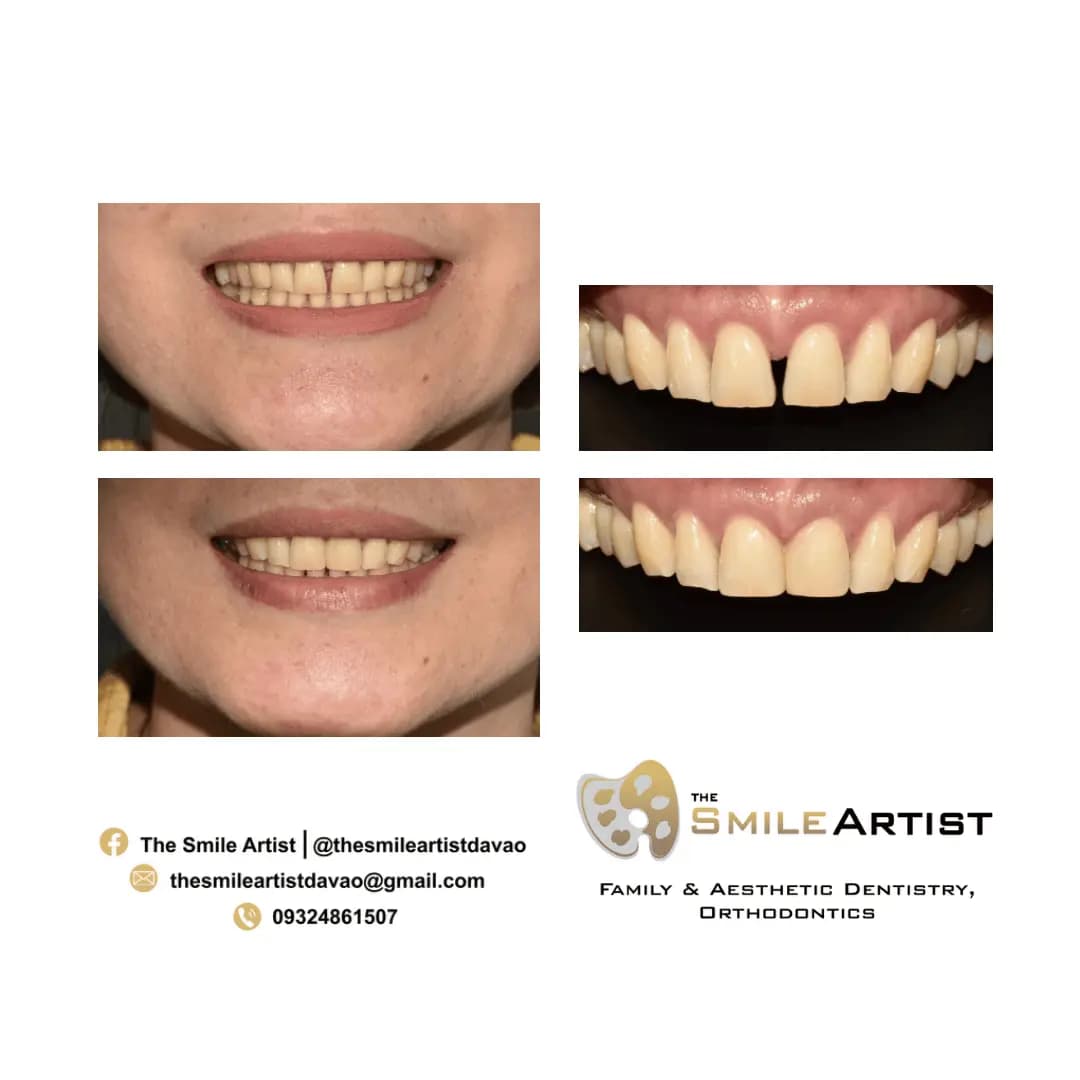 Dental Treatment Result