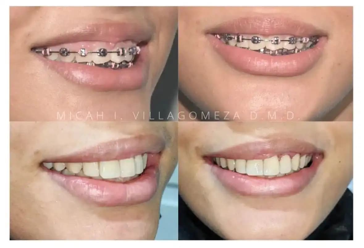 Dental Treatment Result