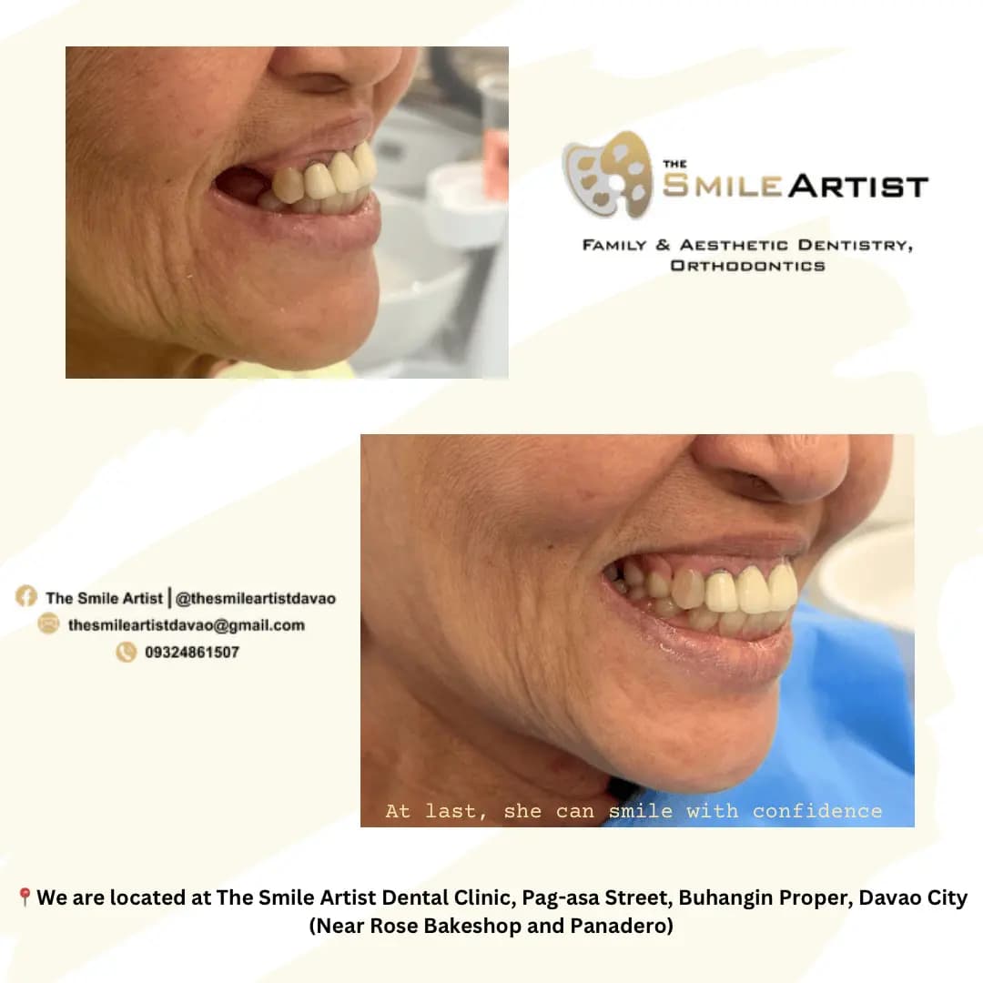 Dental Treatment Result