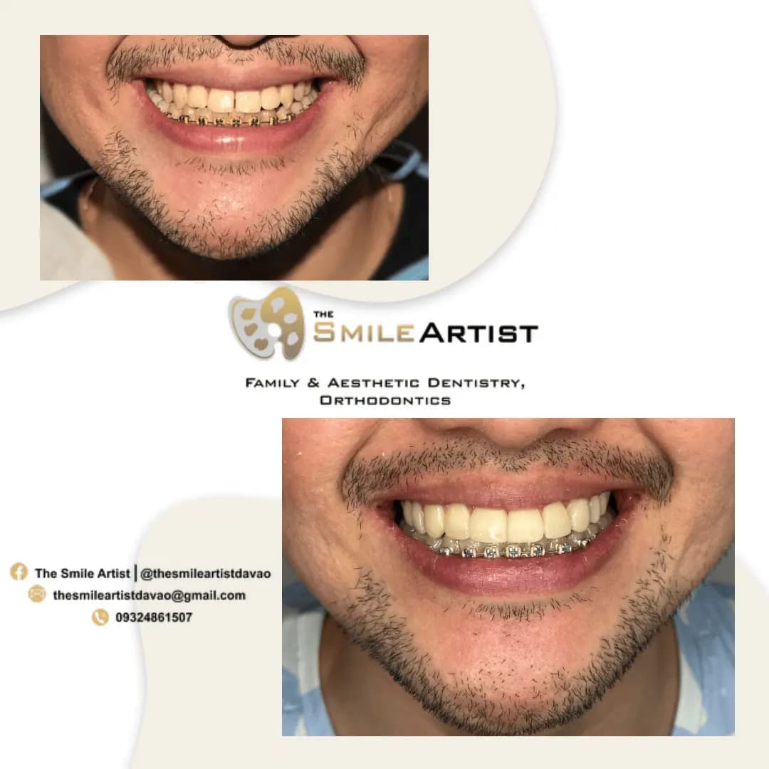 Dental Treatment Result